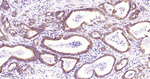 IMP3 Recombinant Rabbit Monoclonal Antibody (3D10)