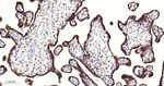IMP3 Antibody in Immunohistochemistry (Paraffin) (IHC (P))