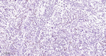 TLE1 Recombinant Rabbit Monoclonal Antibody (7D8)