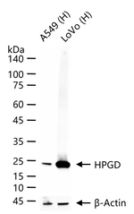 15-PGDH Recombinant Rabbit Monoclonal Antibody (7G3)