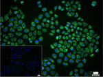PMP70 Recombinant Rabbit Monoclonal Antibody (2D3)
