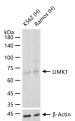 LIMK1 Recombinant Rabbit Monoclonal Antibody (4D1)