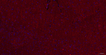 Presenilin 1 Recombinant Rabbit Monoclonal Antibody (5D12)