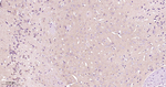 Presenilin 1 Antibody in Immunohistochemistry (Paraffin) (IHC (P))