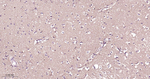 Presenilin 1 Antibody in Immunohistochemistry (Paraffin) (IHC (P))