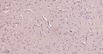 Presenilin 1 Antibody in Immunohistochemistry (Paraffin) (IHC (P))