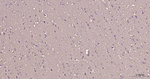 Creatine Kinase BB Recombinant Rabbit Monoclonal Antibody (10G4)