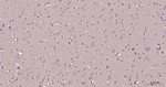 Creatine Kinase BB Antibody in Immunohistochemistry (Paraffin) (IHC (P))