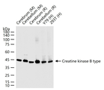 Creatine Kinase BB Antibody in Western Blot (WB)