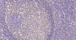 TRF2 Antibody in Immunohistochemistry (Paraffin) (IHC (P))
