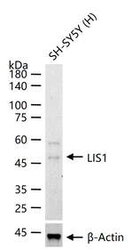 LIS1 Recombinant Rabbit Monoclonal Antibody (2G4)