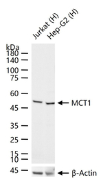 MCT1 Recombinant Rabbit Monoclonal Antibody (9G12)