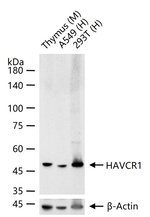 KIM-1 Recombinant Rabbit Monoclonal Antibody (5G7)