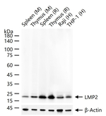 PSMB9 Antibody in Western Blot (WB)