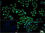 CRM1 Recombinant Rabbit Monoclonal Antibody (10G9)