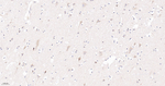 CRM1 Antibody in Immunohistochemistry (Paraffin) (IHC (P))