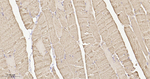 Calsequestrin Recombinant Rabbit Monoclonal Antibody (11G3)