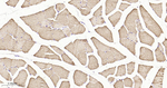 Calsequestrin Antibody in Immunohistochemistry (Paraffin) (IHC (P))