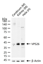 VPS26A Recombinant Rabbit Monoclonal Antibody (4F8)