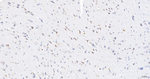 SPRY2 Antibody in Immunohistochemistry (Paraffin) (IHC (P))