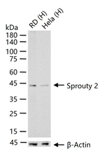 SPRY2 Antibody in Western Blot (WB)