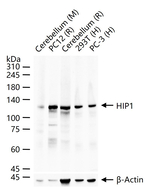 HIP1 Recombinant Rabbit Monoclonal Antibody (2D10)