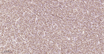 TCL1 Antibody in Immunohistochemistry (Paraffin) (IHC (P))