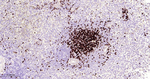 TCL1 Antibody in Immunohistochemistry (Paraffin) (IHC (P))