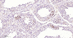 TCL1 Recombinant Rabbit Monoclonal Antibody (4G5)