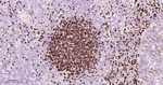 TCL1 Antibody in Immunohistochemistry (Paraffin) (IHC (P))