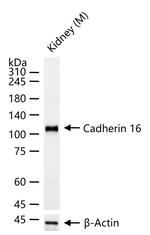 CDH16 Antibody in Western Blot (WB)