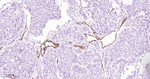 Podocalyxin Antibody in Immunohistochemistry (Paraffin) (IHC (P))