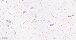 Podocalyxin Antibody in Immunohistochemistry (Paraffin) (IHC (P))