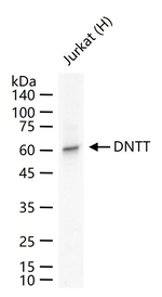 TdT Recombinant Rabbit Monoclonal Antibody (3E11)