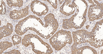 eIF1AX Antibody in Immunohistochemistry (Paraffin) (IHC (P))