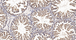 eIF1AX Antibody in Immunohistochemistry (Paraffin) (IHC (P))