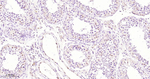 TFE3 Antibody in Immunohistochemistry (Paraffin) (IHC (P))