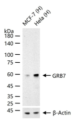 GRB7 Recombinant Rabbit Monoclonal Antibody (2B4)