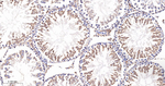 FDFT1 Antibody in Immunohistochemistry (Paraffin) (IHC (P))
