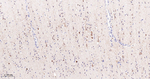 FDFT1 Antibody in Immunohistochemistry (Paraffin) (IHC (P))