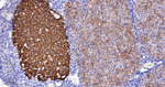 FDFT1 Antibody in Immunohistochemistry (Paraffin) (IHC (P))