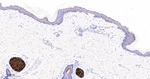 FDFT1 Antibody in Immunohistochemistry (Paraffin) (IHC (P))