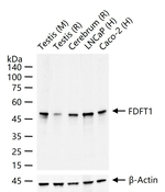 FDFT1 Antibody in Western Blot (WB)