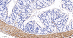 TAGLN Antibody in Immunohistochemistry (Paraffin) (IHC (P))