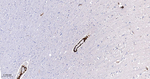 TAGLN Antibody in Immunohistochemistry (Paraffin) (IHC (P))