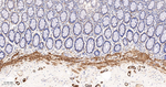 TAGLN Antibody in Immunohistochemistry (Paraffin) (IHC (P))