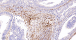 TAGLN Antibody in Immunohistochemistry (Paraffin) (IHC (P))