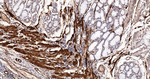 TAGLN Antibody in Immunohistochemistry (Paraffin) (IHC (P))