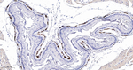 TAGLN Antibody in Immunohistochemistry (Paraffin) (IHC (P))