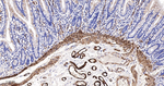 TAGLN Antibody in Immunohistochemistry (Paraffin) (IHC (P))